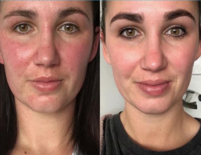 4B7E6E8F 5DB6 491E A36B 886BBC88E681