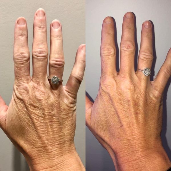 AF420398 553B 4D12 9333 A4DB4F413518